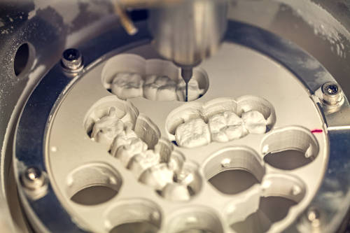 Protesi estetica in zirconia e strutture in peek Juvora