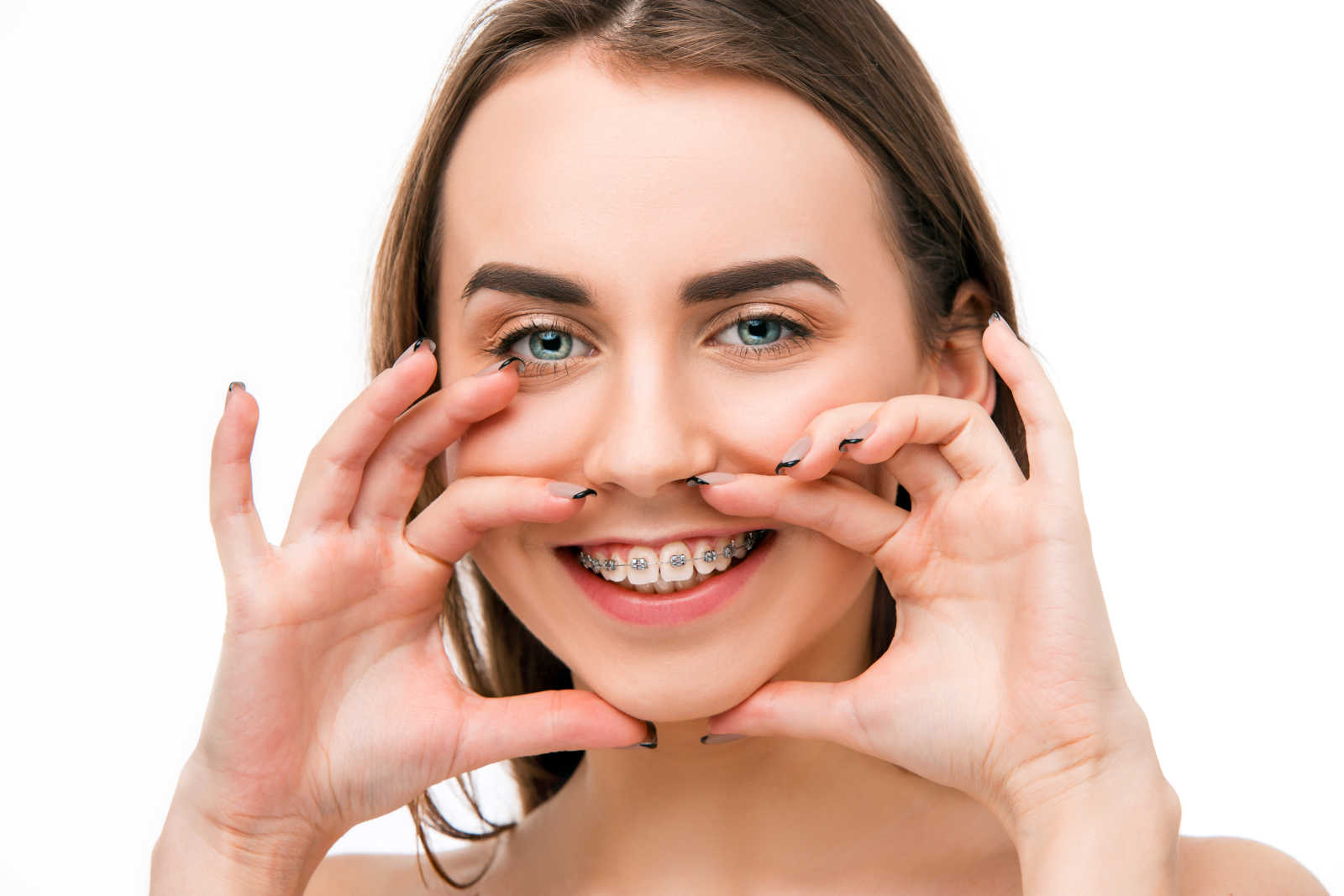 ortodonzia dell adulto dental smile clinic milano viale monza